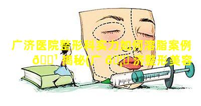 广济医院整形科实力如何溶脂案例 🌹 揭秘(广 🦅 济整形美容医院怎么样)